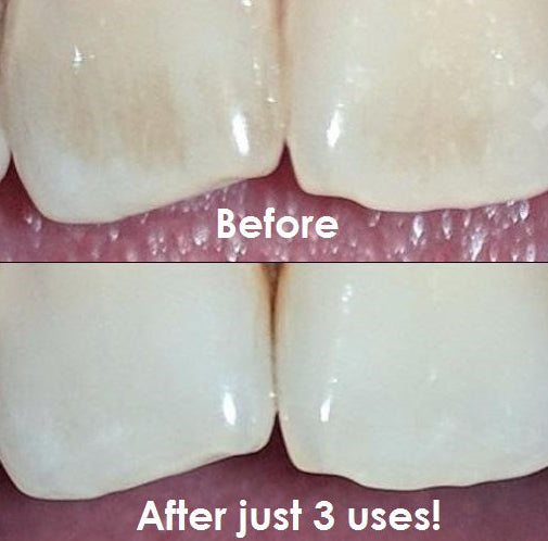 Teeth Cleaning Powder (Vitamins & Aloe Vera Infused)